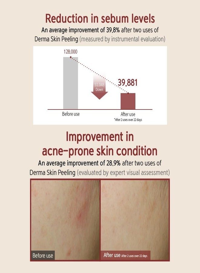 BQCELL [BQCELL] [Made In Korea] [DERMA SKIN PEELING 2g / Recell Cure Serum 2ml, Safety Cap 1ea, 3set], Acne Skin Available, Exfoliating, Facial Scrub, Korean Beauty, Blackhead Remover - Image 5